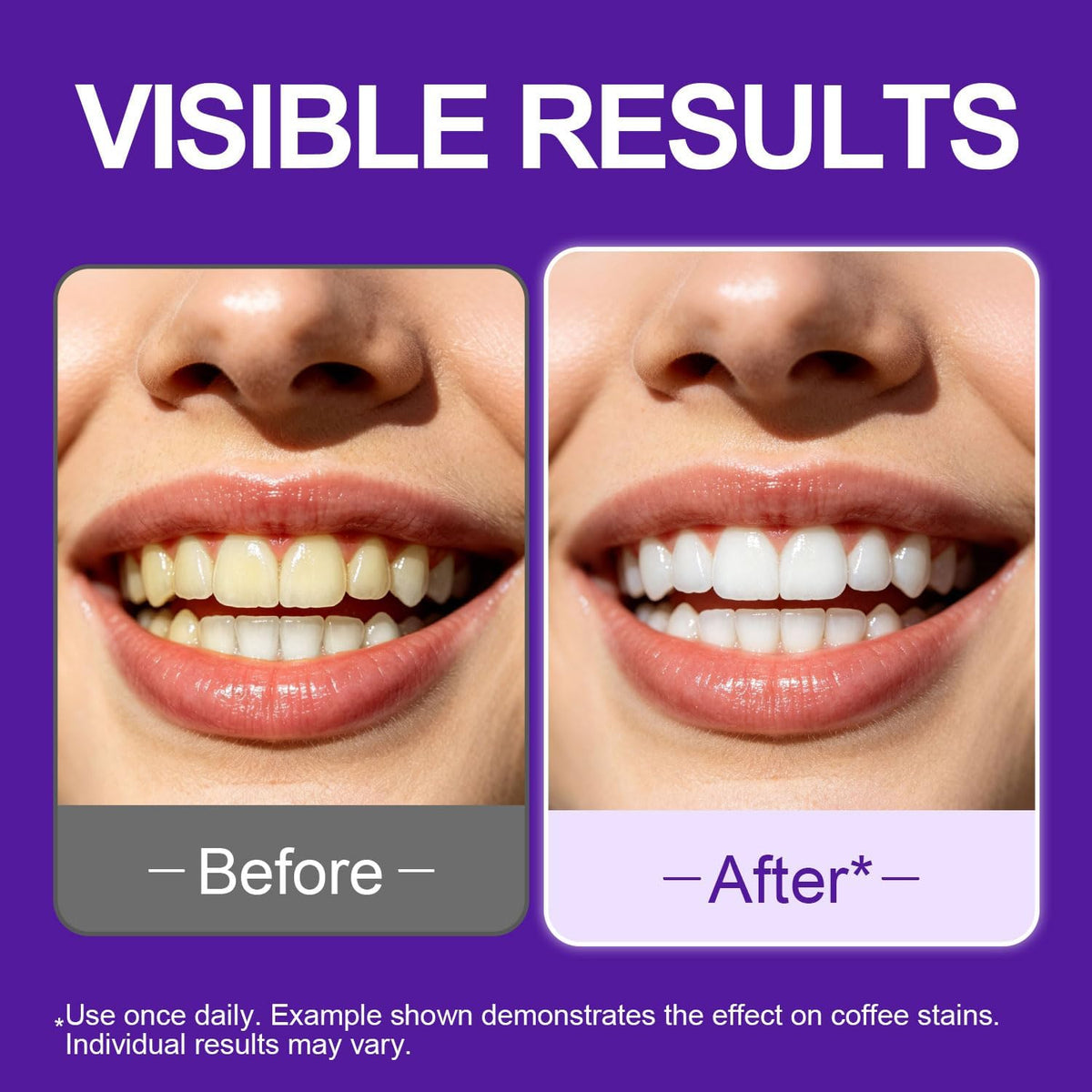 Enamel-Safe Brightening strips