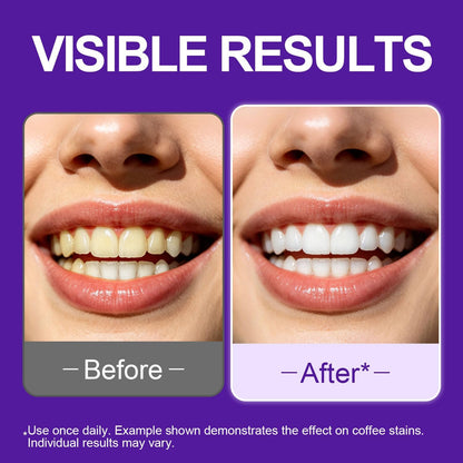 Enamel-Safe Brightening strips